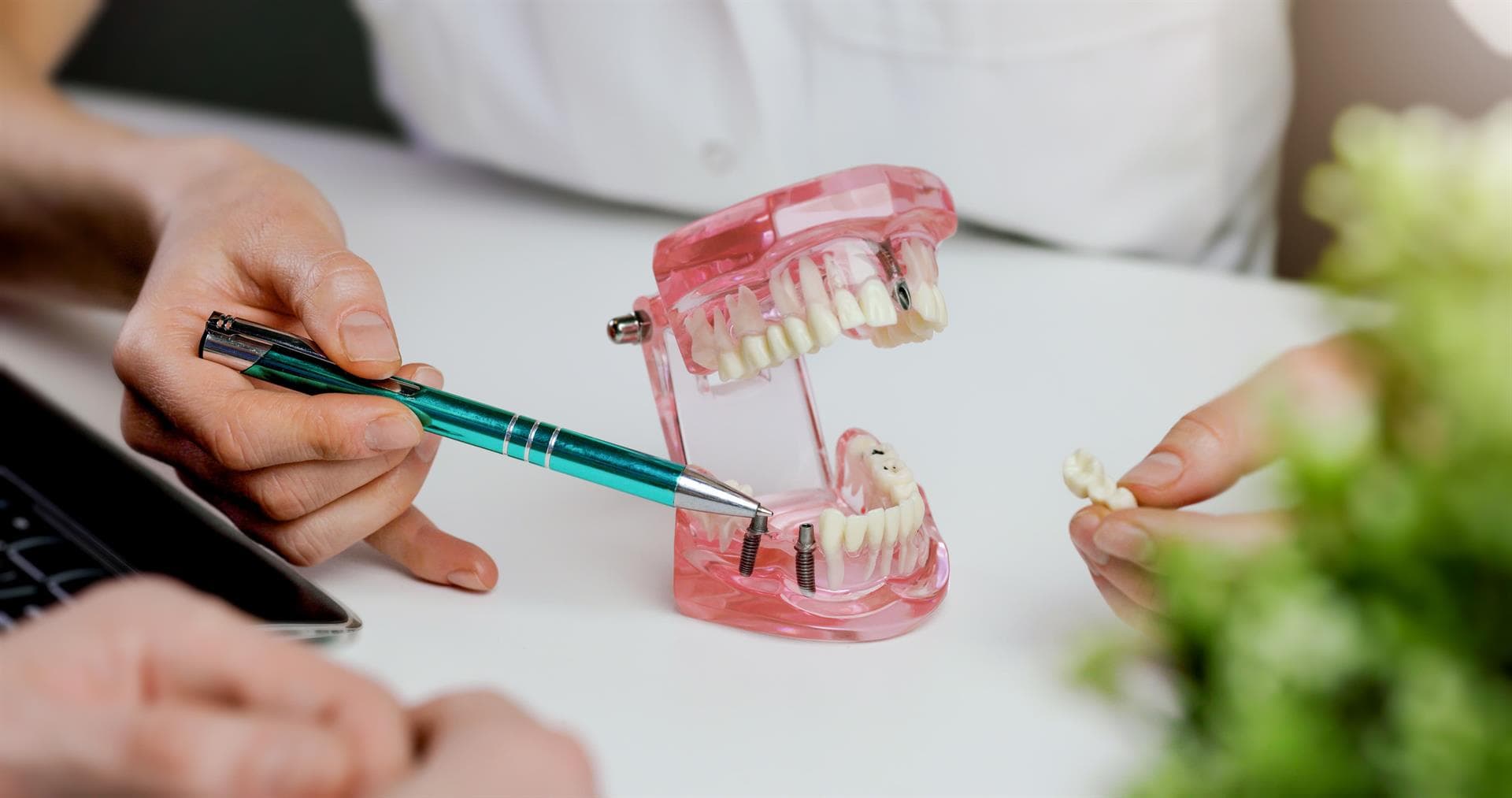 Centro Odontológico Dentine - Gingivectomías