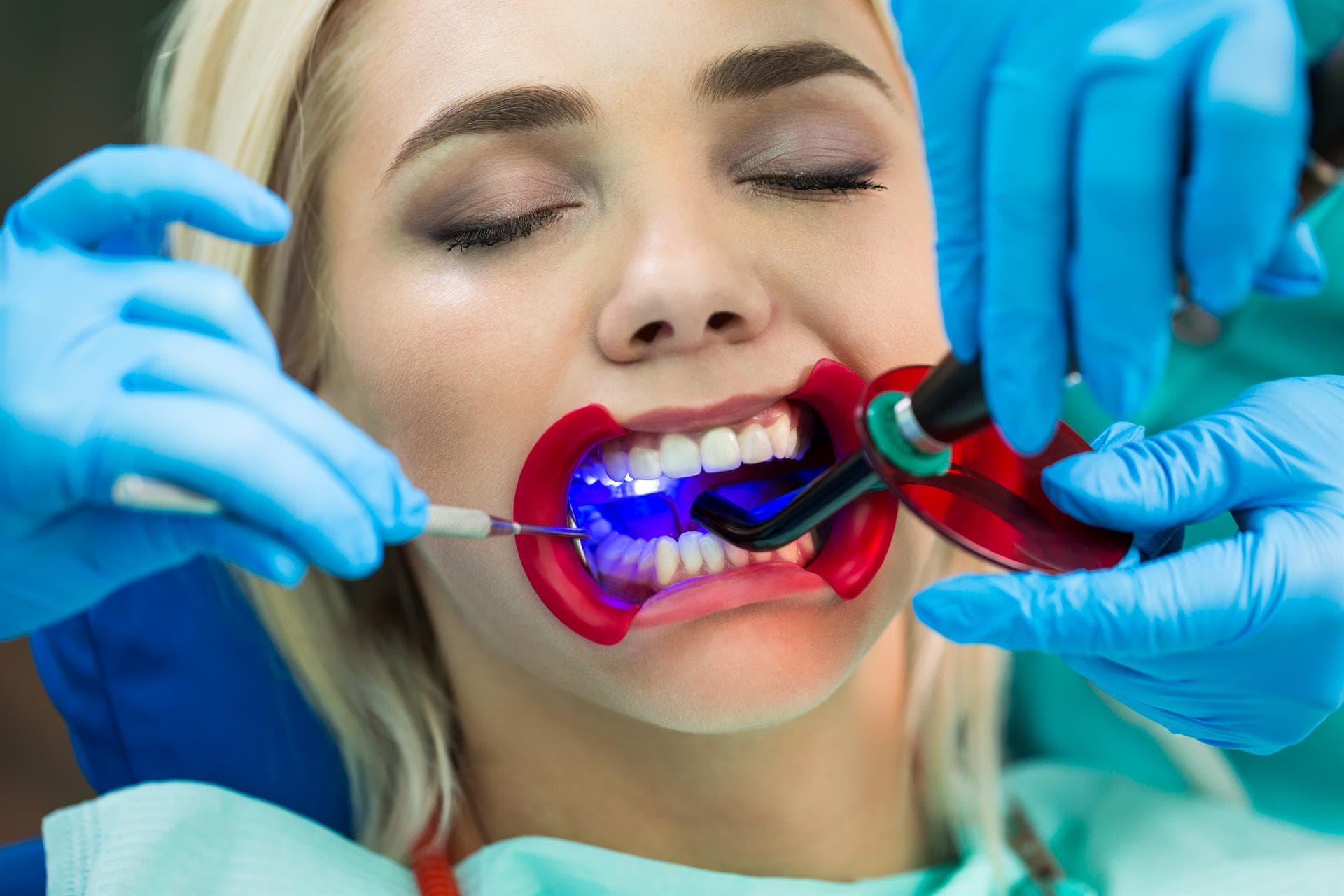Centro Odontológico Dentine - Otros tratamientos de estética dental