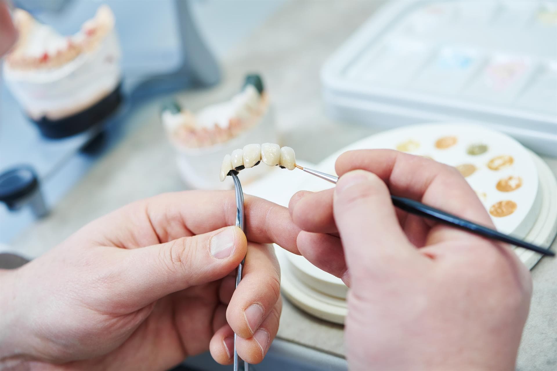 Centro Odontológico Dentine - Prótesis dentales fijas