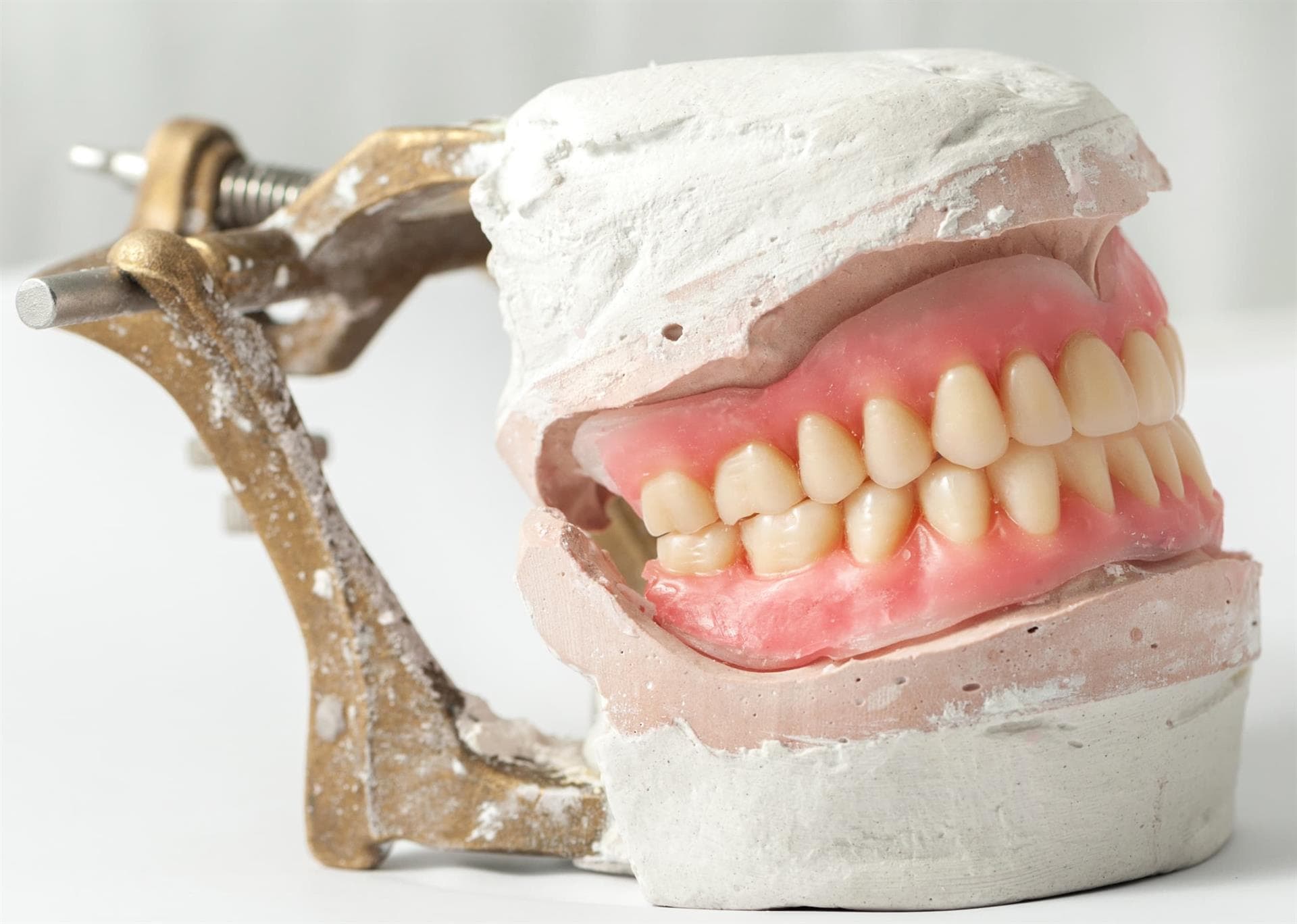 Centro Odontológico Dentine - Prótesis dentales